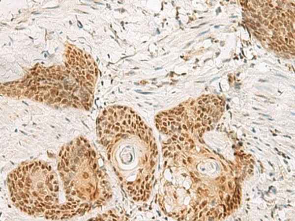 Anti-Human/Mouse/Rat PSPC1 Antibody