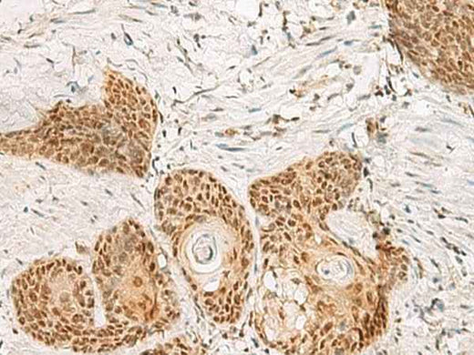 Anti-Human/Mouse/Rat PSPC1 Antibody