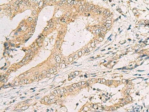 Anti-Human SPACA1 Antibody