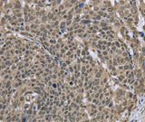 Anti-Human/Mouse/Rat DCTN4 Antibody - ABMIUM