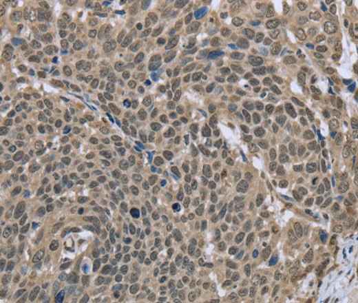 Anti-Human/Mouse/Rat DCTN4 Antibody