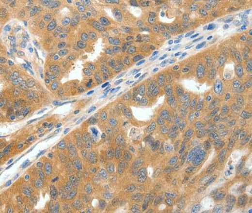 Anti-Human SCN9A Antibody