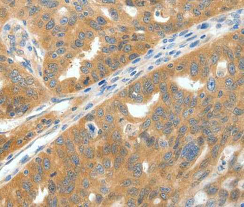 Anti-Human SCN9A Antibody