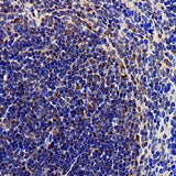 Immunohistochemistry analysis of paraffin-embedded mouse spleen using SOCS1 Polyclonal Antibody at dilution of 1:300.