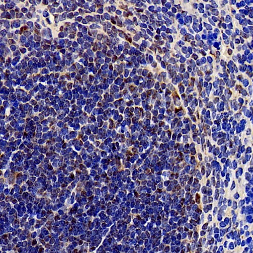 Immunohistochemistry analysis of paraffin-embedded mouse spleen using SOCS1 Polyclonal Antibody at dilution of 1:300.