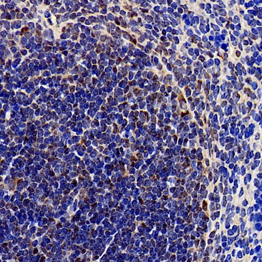Immunohistochemistry analysis of paraffin-embedded mouse spleen using SOCS1 Polyclonal Antibody at dilution of 1:300.