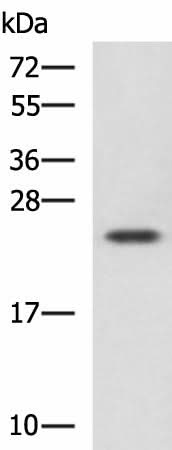 Western blot analysis of Jurkat cell lysate using CBX5 Polyclonal Antibody at dilution of 1:1100