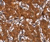 Anti-Human/Mouse/Rat HCAR2 Antibody - ABMIUM