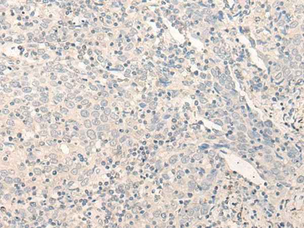 Anti-Human RADIL Antibody