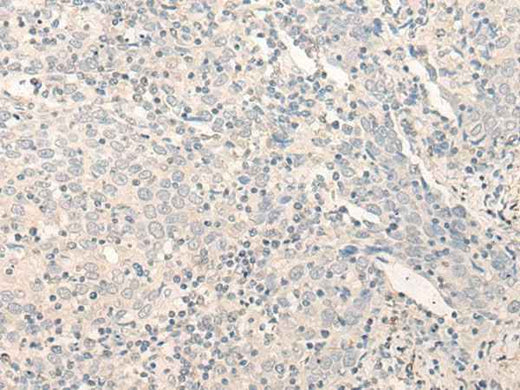 Anti-Human RADIL Antibody