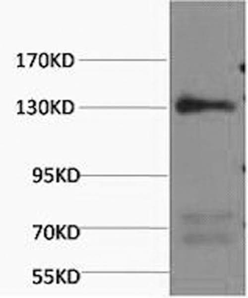 Western Blot analysis of Rat heart using NOS3 Monoclonal Antibody at dilution of 1:1000.