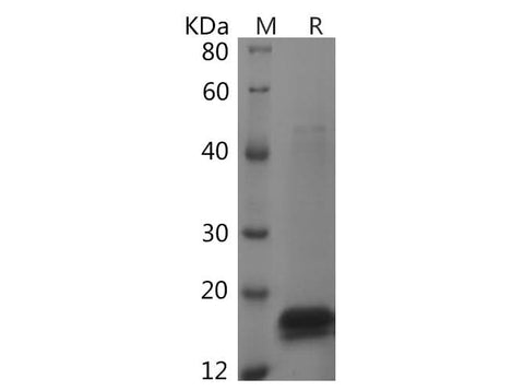 SDS-PAGE analysis of Rat TNF-αsf proteins, 2 μg/lane of Recombinant Rat TNF-αsf proteins was resolved with SDS-PAGE under reducing conditions, showing bands at 19 kDa.