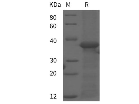 SDS-PAGE analysis of Rat C4 proteins, 2 μg/lane of Recombinant Rat C4 proteins was resolved with SDS-PAGE under reducing conditions, showing bands at 36 kDa.