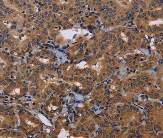 Anti-Human/Mouse/Rat GRK1 Antibody