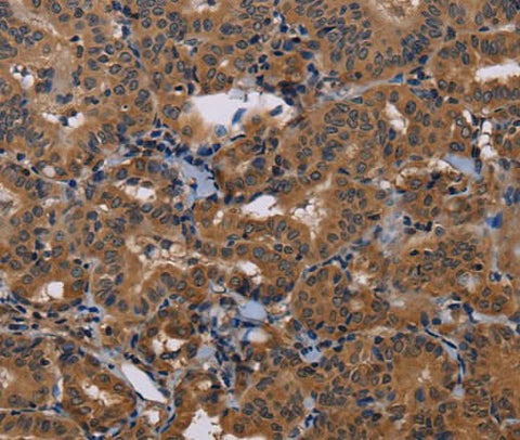 Anti-Human/Mouse/Rat GRK1 Antibody - ABMIUM