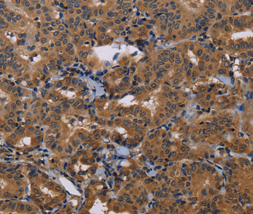 Anti-Human/Mouse/Rat GRK1 Antibody - ABMIUM