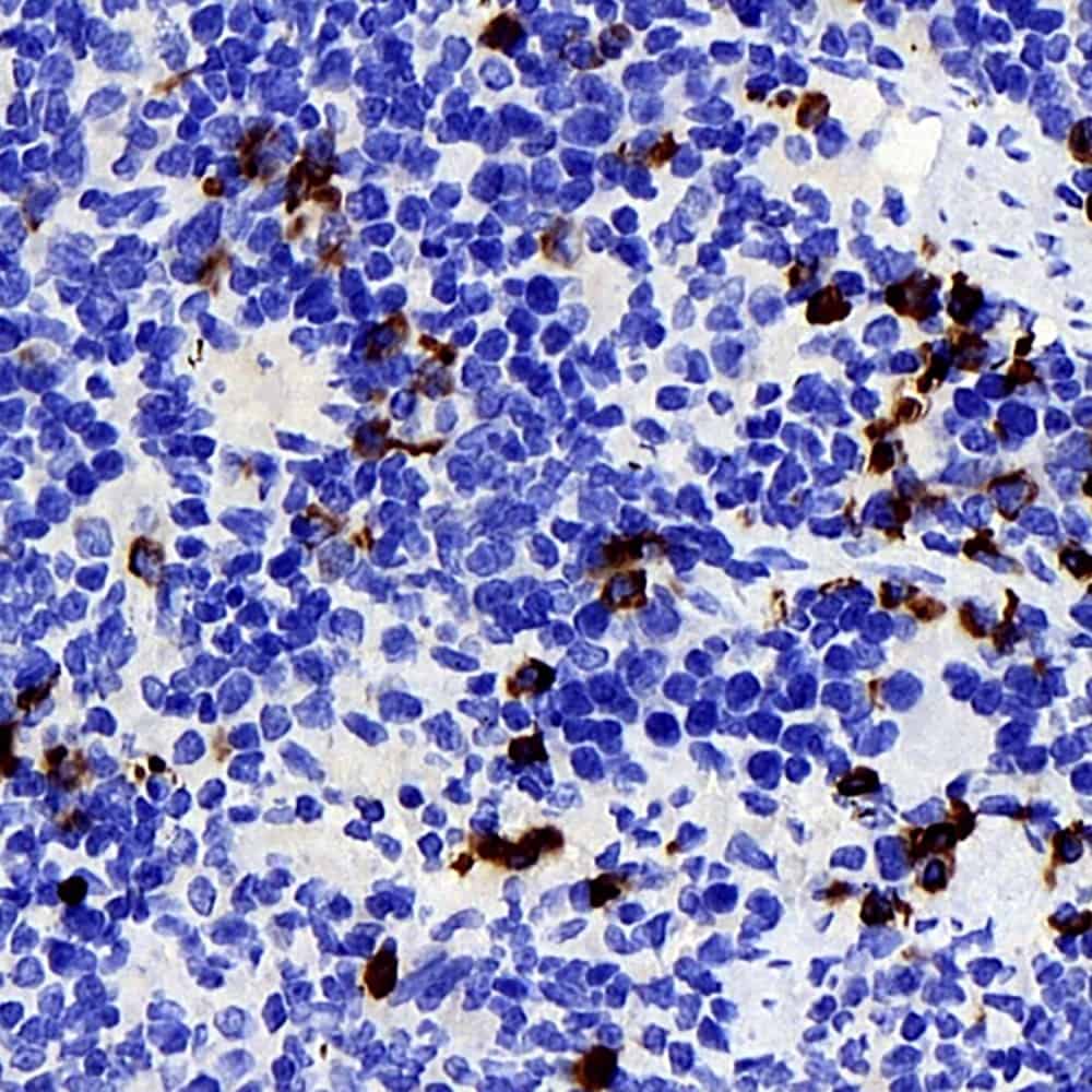Immunohistochemistry analysis of parafffin-embedded mouse spleen using P2RX3 Polyclonal Antibody at dilution of 1:400.