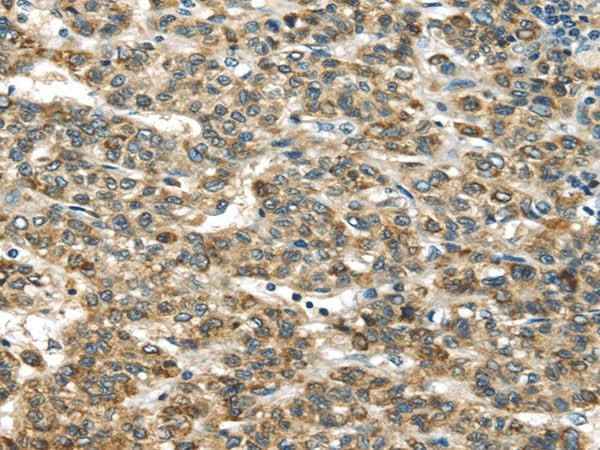 Anti-Human TNFAIP2 Antibody