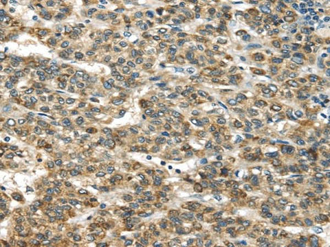 Anti-Human TNFAIP2 Antibody - ABMIUM