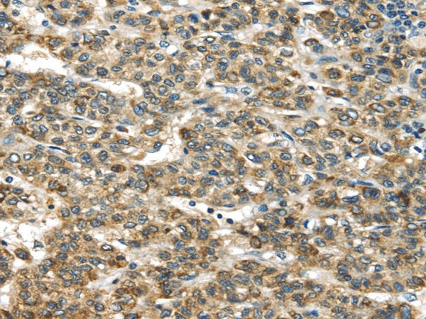 Anti-Human TNFAIP2 Antibody - ABMIUM