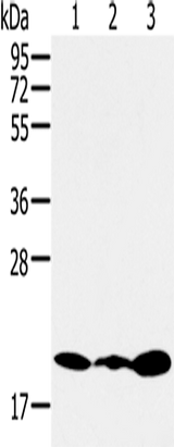 Anti-Human/Mouse/Rat RNF5 Antibody - ABMIUM