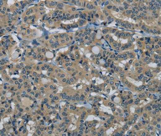 Anti-Human/Mouse HSPG2 Antibody