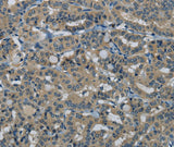 Anti-Human/Mouse HSPG2 Antibody - ABMIUM