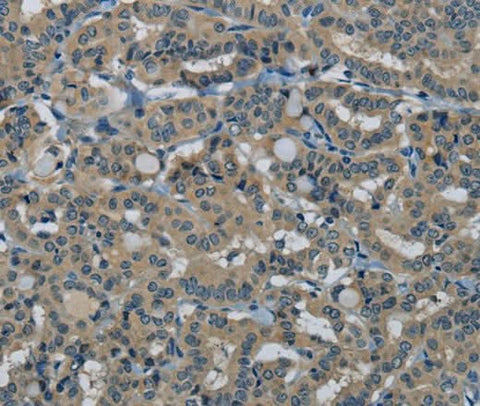 Anti-Human/Mouse HSPG2 Antibody - ABMIUM