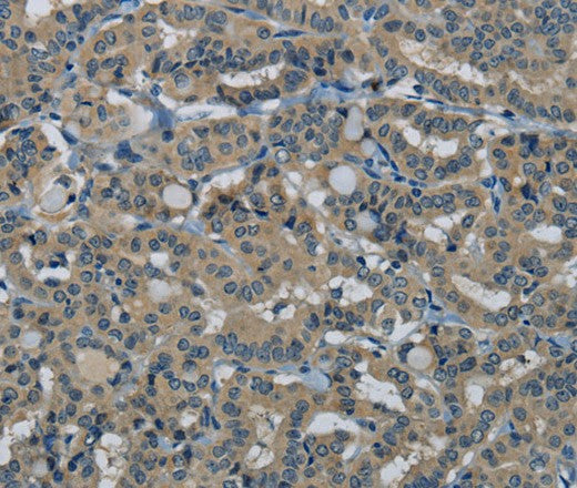 Anti-Human/Mouse HSPG2 Antibody - ABMIUM