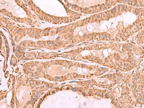 Anti-Human/Mouse/Rat CDC20 Antibody