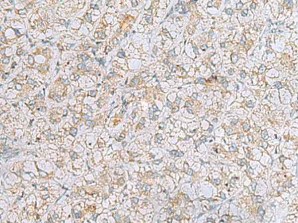 Anti-Human/Mouse LRRC49 Antibody