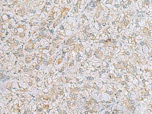 Anti-Human/Mouse LRRC49 Antibody