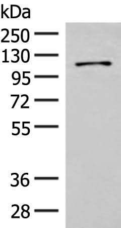 Western blot analysis of Hela cell lysate using FANCB Polyclonal Antibody at dilution of 1:550