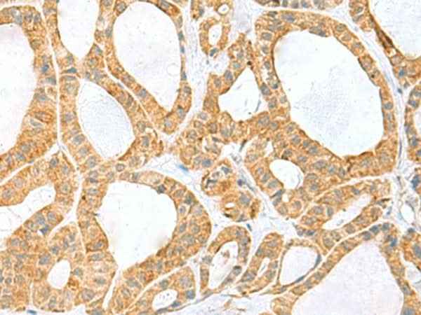 Anti-Human/Mouse PPIH Antibody
