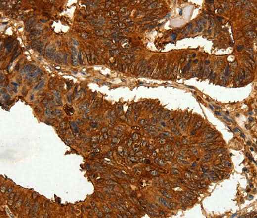 Anti-Human CEACAM21 Antibody