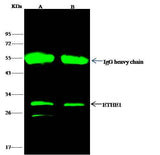 Anti-Human ETHE1 Antibody [A1238] - ABMIUM