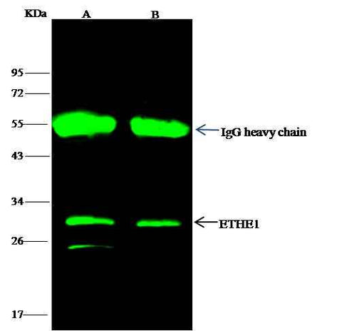Anti-Human ETHE1 Antibody [A1238] - ABMIUM