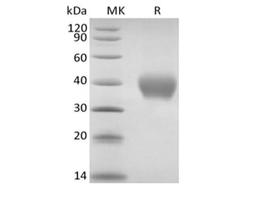 Recombinant Rhesus Macaque TNF Receptor II/TNF RII/TNFRSF1B/CD120b (C-6His) - ABMIUM