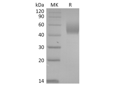 Recombinant SARS-CoV-2 Spike Protein (NTD, His Tag) - ABMIUM