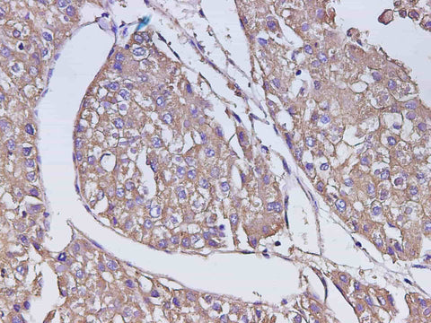 Anti-Human AFP Antibody - ABMIUM