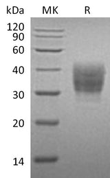 Recombinant Mouse SLAMF7/CD319 Protein (His Tag) - ABMIUM
