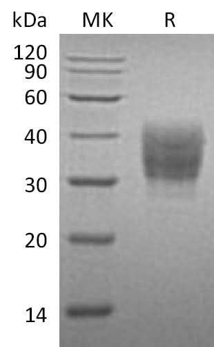 Recombinant Mouse SLAMF7/CD319 Protein (His Tag) - ABMIUM