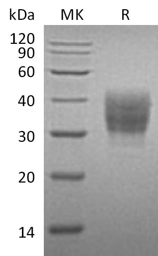 Recombinant Mouse SLAMF7/CD319 Protein (His Tag) - ABMIUM