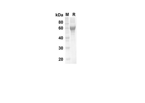 SDS-PAGE analysis of Rat KIM-1 proteins, 2 μg/lane of Recombinant Rat KIM-1 proteins was resolved with SDS-PAGE under reducing conditions, showing bands at 23.4 kDa.