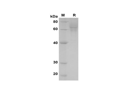 SDS-PAGE analysis of Human IL6RA/CD126 proteins, 2 μg/lane of Recombinant Human IL6RA/CD126 proteins was resolved with SDS-PAGE under reducing conditions, showing bands at 65 kDa.