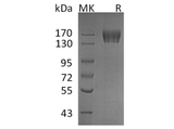 Recombinant Human c-KIT/CD117 Protein (His Tag) - ABMIUM