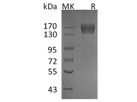 Recombinant Human c-KIT/CD117 Protein (His Tag) - ABMIUM