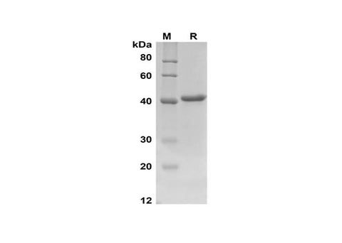 SDS-PAGE analysis of Rat IFN-γ proteins,2 μg/lane of Recombinant Rat IFN-γ proteins,was resolved with SDS-PAGE under reducing conditions,showing bands at 41 kDa.