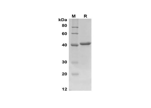 SDS-PAGE analysis of Rat IFN-γ proteins,2 μg/lane of Recombinant Rat IFN-γ proteins,was resolved with SDS-PAGE under reducing conditions,showing bands at 41 kDa.