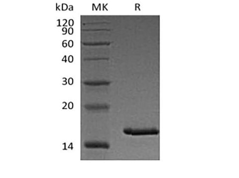 Recombinant Cynomolgus Thymic Stromal Lymphopoietin/TSLP (C-6His) - ABMIUM